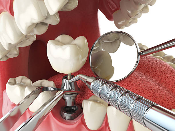 Best 24-Hour Emergency Dentist in Colonial Heights, TN